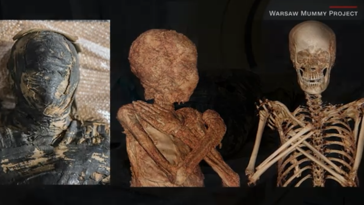 An antiquated Egyptian mummy is found to be a mama.